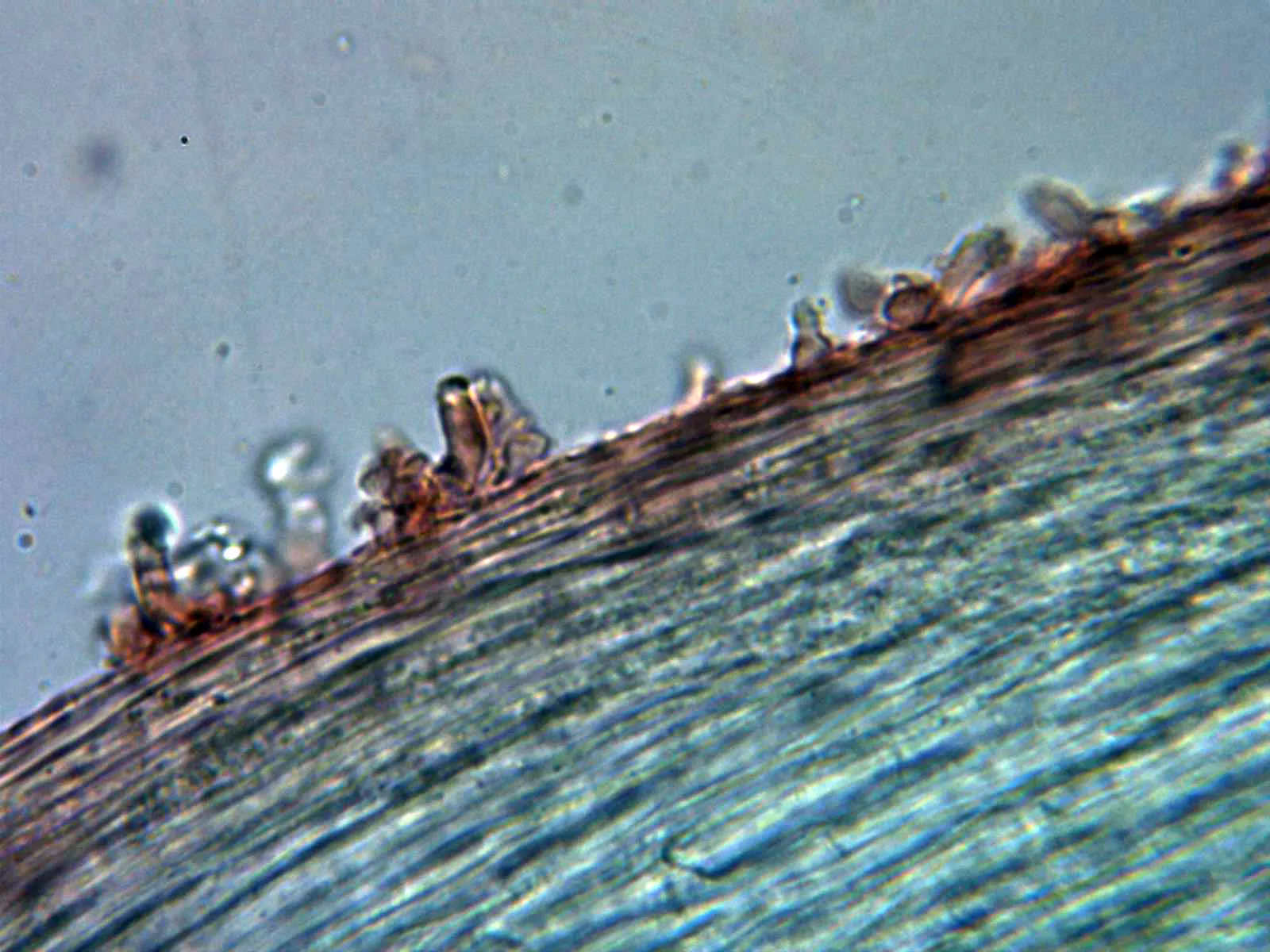Microscopía de Mycena acicula - 11 - Caulocistidios
